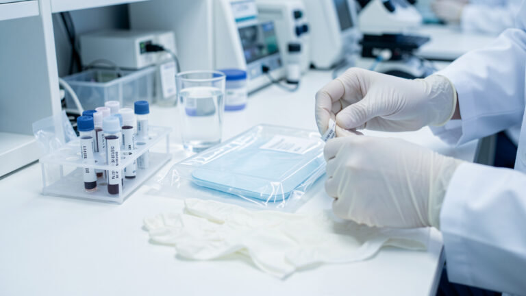 Poste de laboratoire médical propre avec tubes d’échantillons, récipient stérile, gants jetables et verre d’eau soigneusement disposés pour préparer des analyses fiables.
